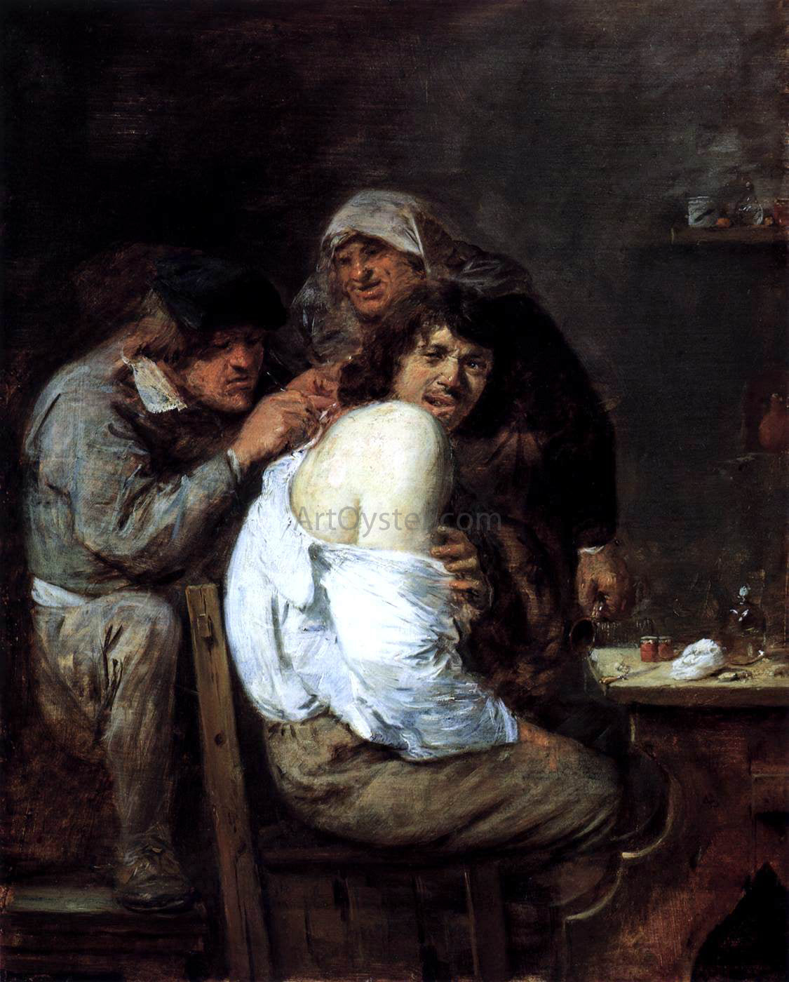 Adriaen Brouwer The Back Operation - Hand Painted Oil Painting