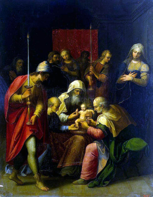  Luis De Carbajal Circumcision - Hand Painted Oil Painting